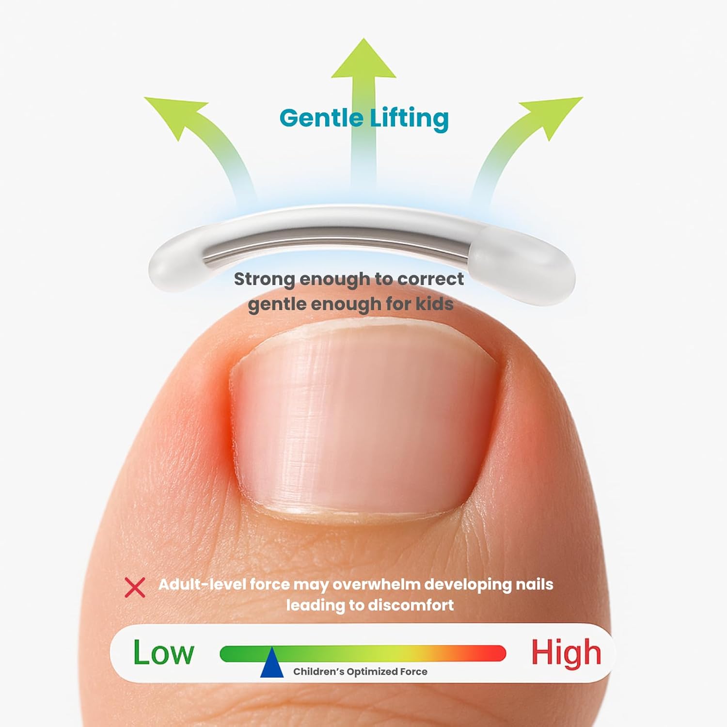 Kids Ingrown Toenail Corrector, Gentle & Safe Ingrown Toenail Treatment for Children, At-Home Solution for Kids Ingrown Curved Nails, Comfortable Lift for Delicate Nails (0.31/0.39/0.43 Inch)