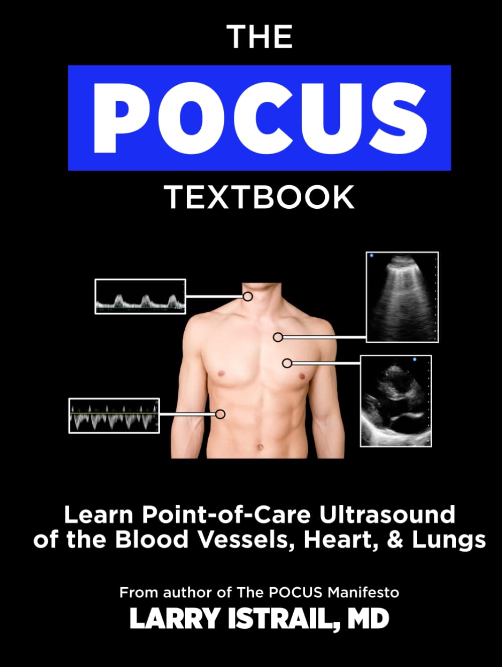 The POCUS Textbook: Learn Point-of-Care Ultrasound of the Blood Vessels, Heart, & Lungs      Hardcover – October 8, 2025
