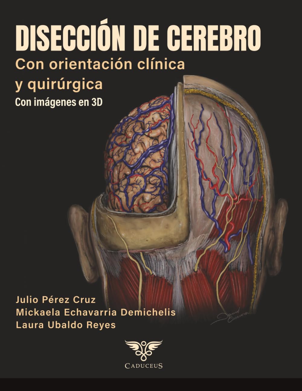 Disección de cerebro con orientación clínica y quirúrgica: Con imágenes en 3D