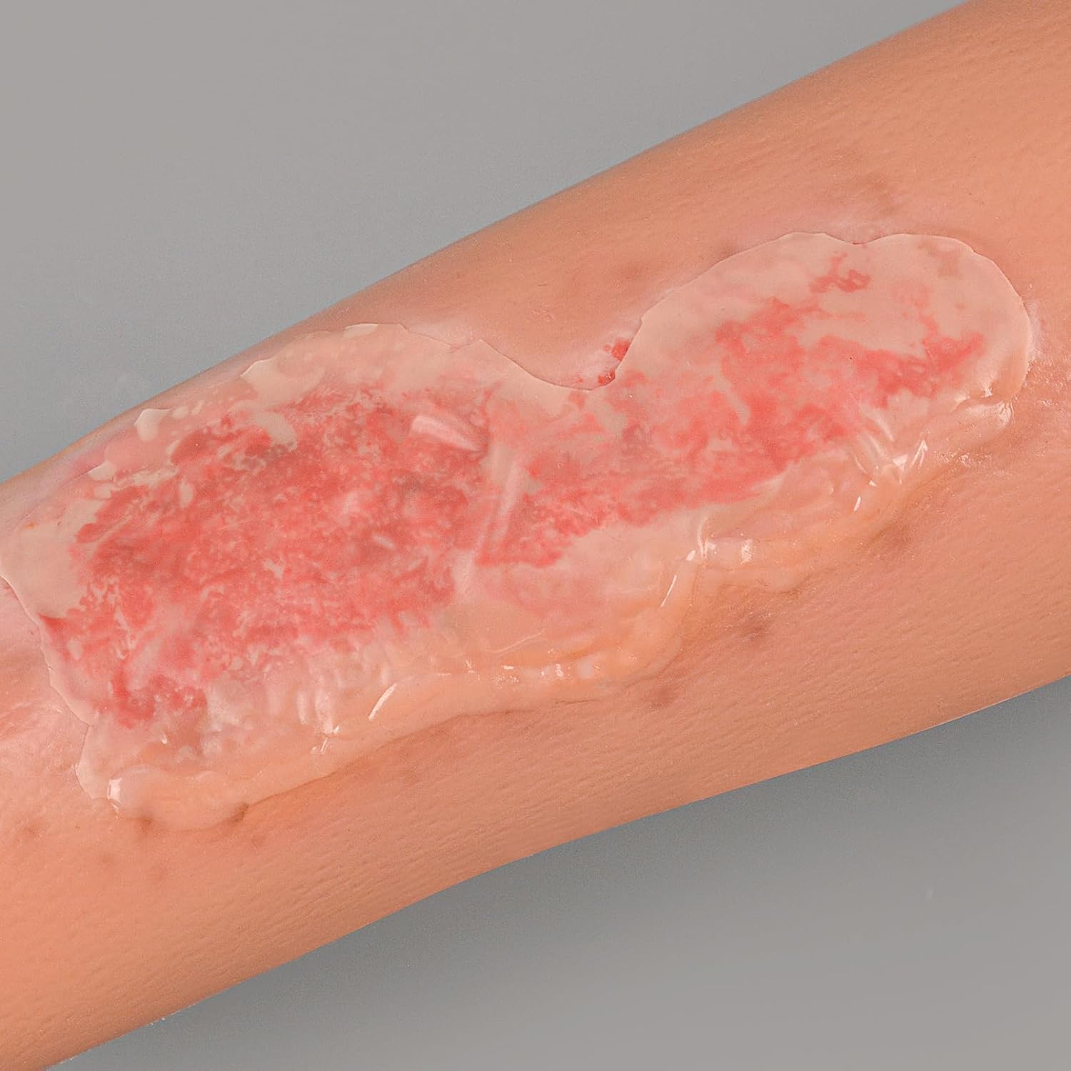 Abrasion Wundversorgung Training Sleeve, Wunde Packung Trainer, Wearable Trauma Hautmodell, Medizinische Ausbildung Modell, Wunde Reinigung Behandlung Modell, Für Medizinische Klassen, Arzt