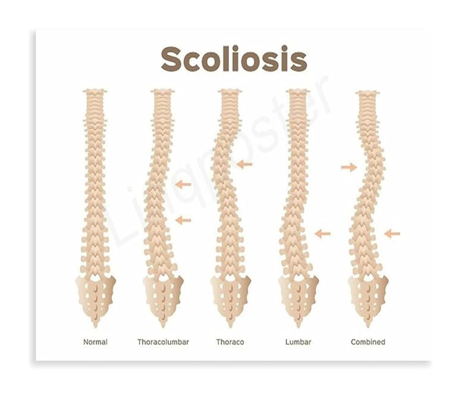 VWWJCCRO Vintage Anatomical Spine Illustration Educational Wall-Art for Hospital Waiting Room Decor