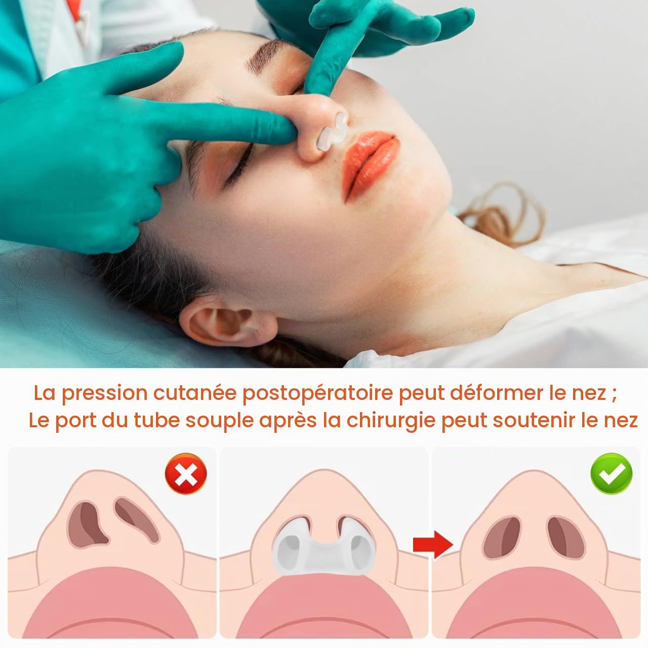 FOMIYES Lot de 2 fixateurs d'expansion nasale - Pour la récupération après une chirurgie nasale - Protection nasale pour nez cassé - Gel de silice transparent