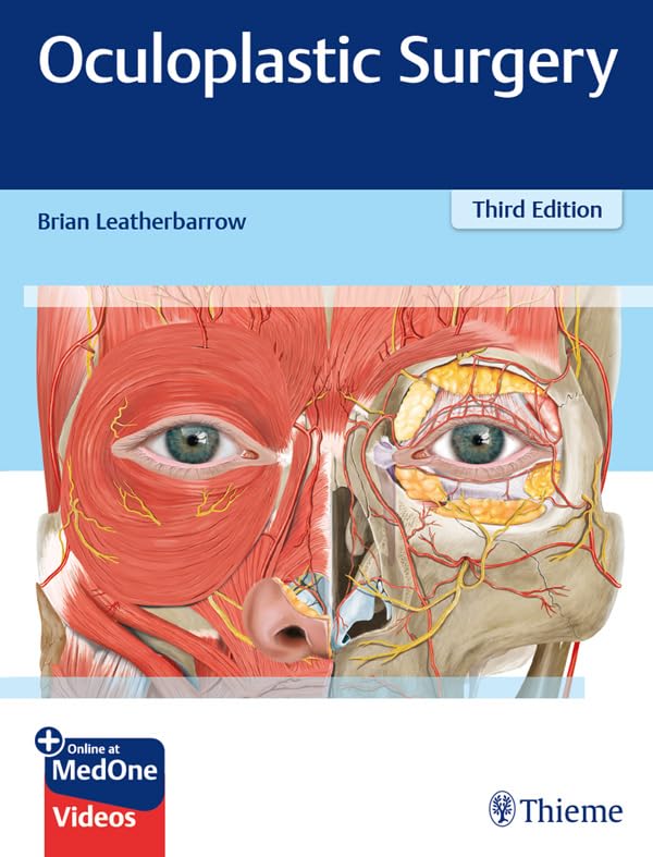 Oculoplastic Surgery (English Edition)