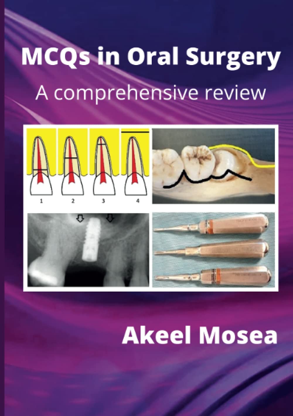 MCQS in Oral Surgery
