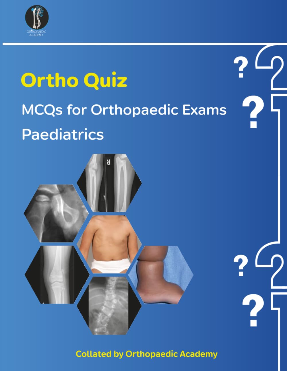 Ortho Quiz : Paediatric MCQs (Concise Orthopaedics)