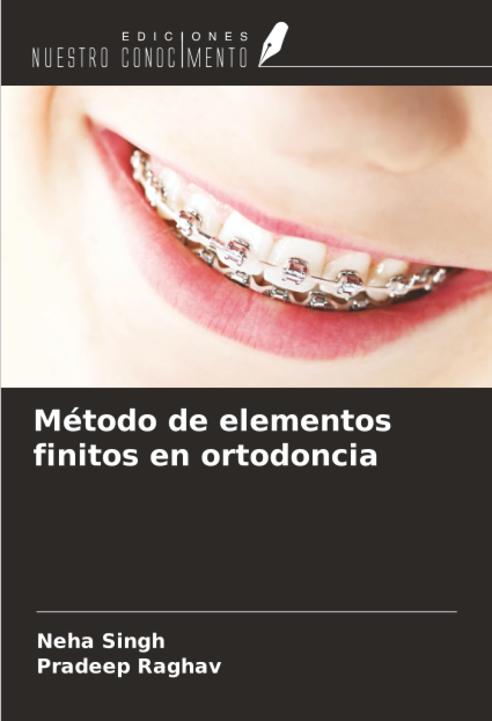 Método de elementos finitos en ortodoncia