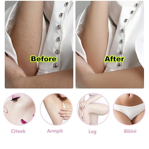 Miniatura 5 de Mini afeitadora eléctrica para mujer, afeitadora portátil para depilación  uso húmedo y seco sin dolor para cara, brazos, axilas, área del bikini y