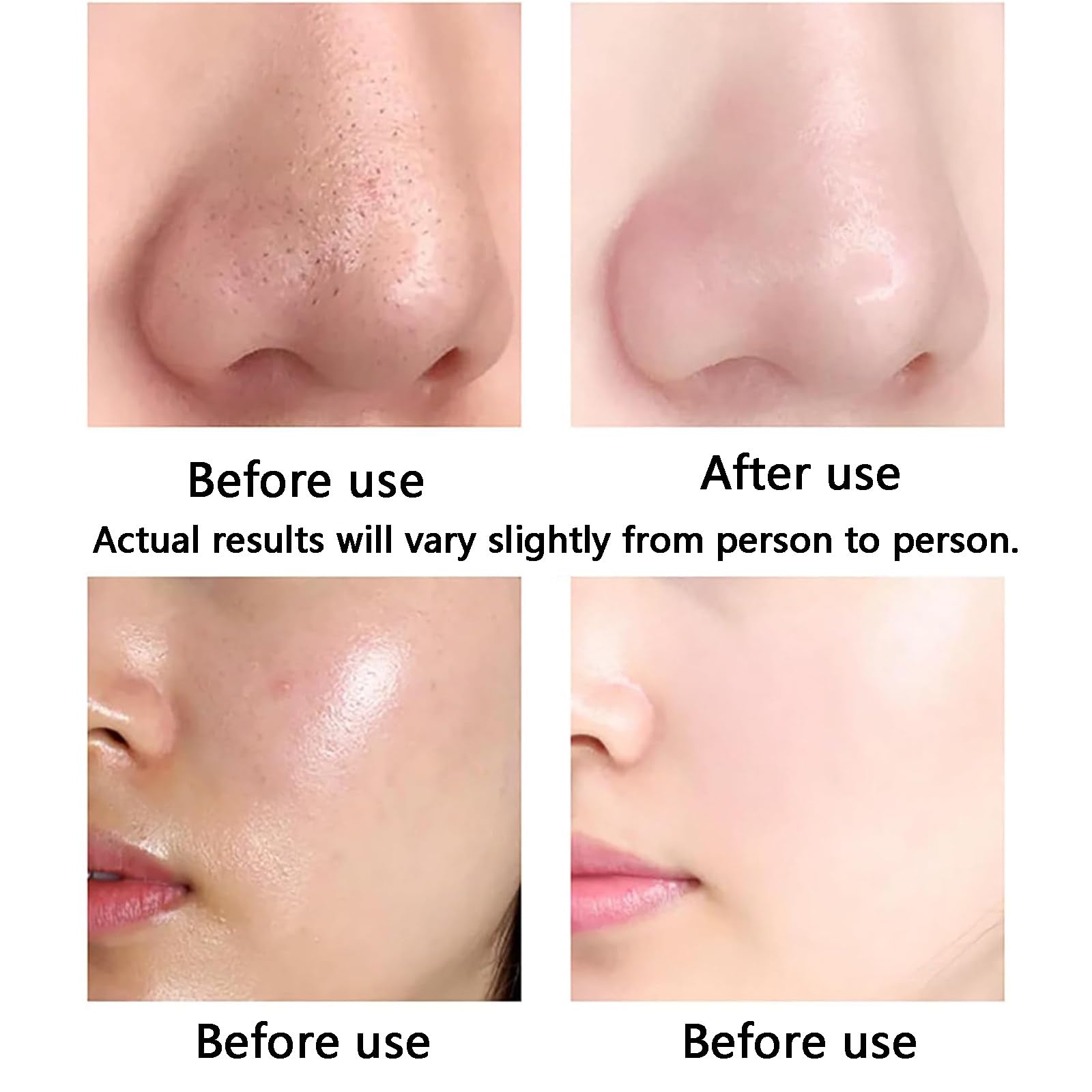Hydrafacial-Maschine Wasserstoff-Sauerstoff-Gesichtsmaschine 8-Zoll-LCD-Bildschirm 10 Köpfe Hautreinigung Befeuchtung Nährstoffaufnahme Spa
