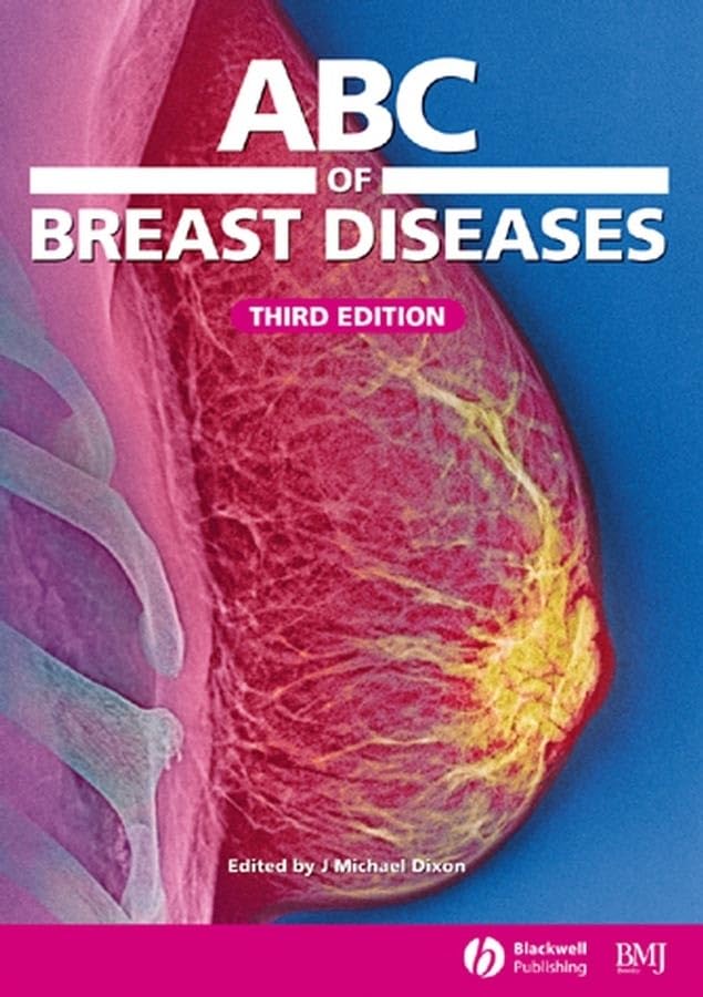Buy Abc Of Breast Diseases (ABC Series) — BookShops.in