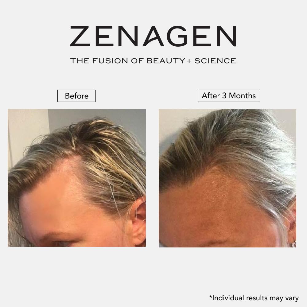 Zenagen Revolve Thickening Shampoo & Conditioner Bundle for Women, 13.5 oz