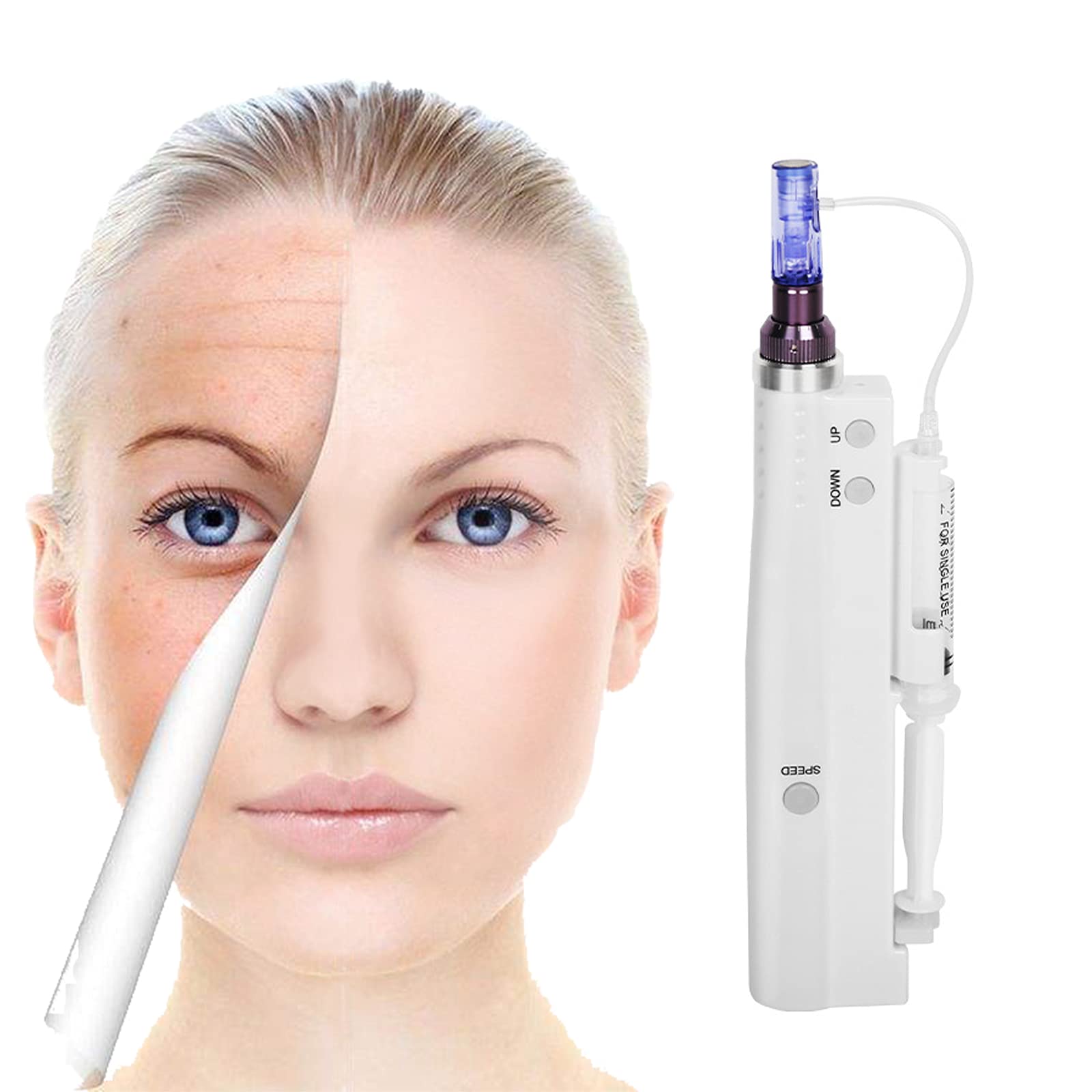 Microneedle Pen eléctrico Recargable Inalámbrico 5 Velocidades Automático con 2+10 cartuchos nano para Eliminación Acné,Arrugas, Estrías,Cuidado De Piel