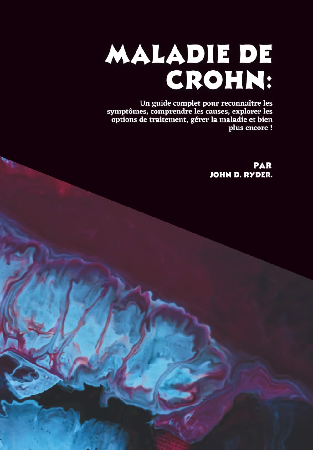 Maladie de Crohn: Un guide complet pour reconnaître les symptômes, comprendre les causes, explorer les options de traitement, gérer la maladie et bien plus encore !