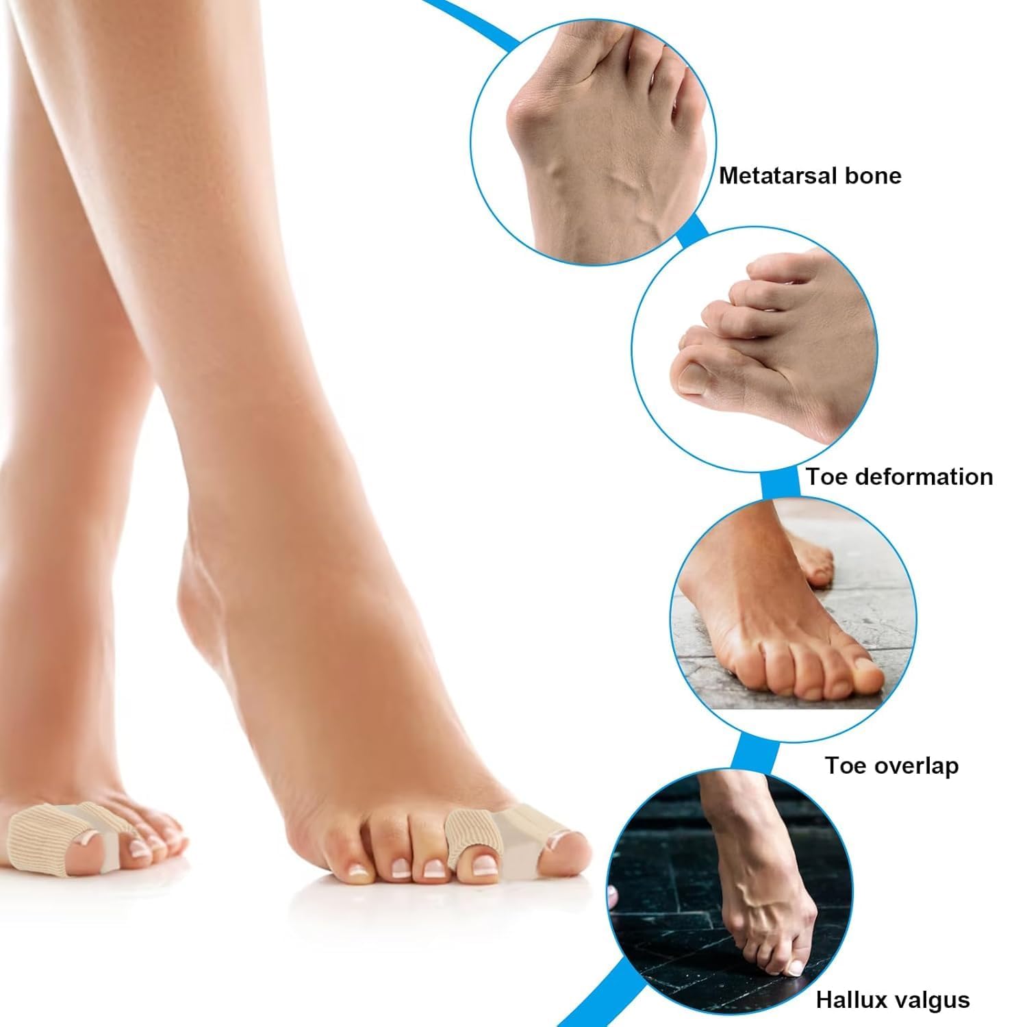 LUVINA Gel Toe Separators for Bunions – Breathable Fabric Toe Spacers with Gel Lining for Bunion Pain Relief & Hammer Toe Correction – 2-Loop Design for Men & Women (1, S) - Image 7 thumbnail