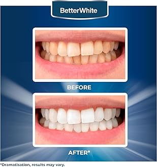 Professional Teeth Whitening Strips 7 Treatments - Enamel Safe - Non-Sensitive Formula - 14 Peroxide-Free Whitening Strips - Dentist Formulated Teeth Whitening Kit