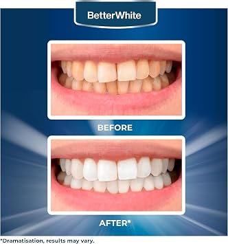 BetterWhite Professional Teeth Whitening Strips 7 Treatments - Enamel Safe - Non-Sensitive Formula - Peroxide-Free Whitening Strips - Dentist Formulated Teeth Whitening Kit (14 Strips)
