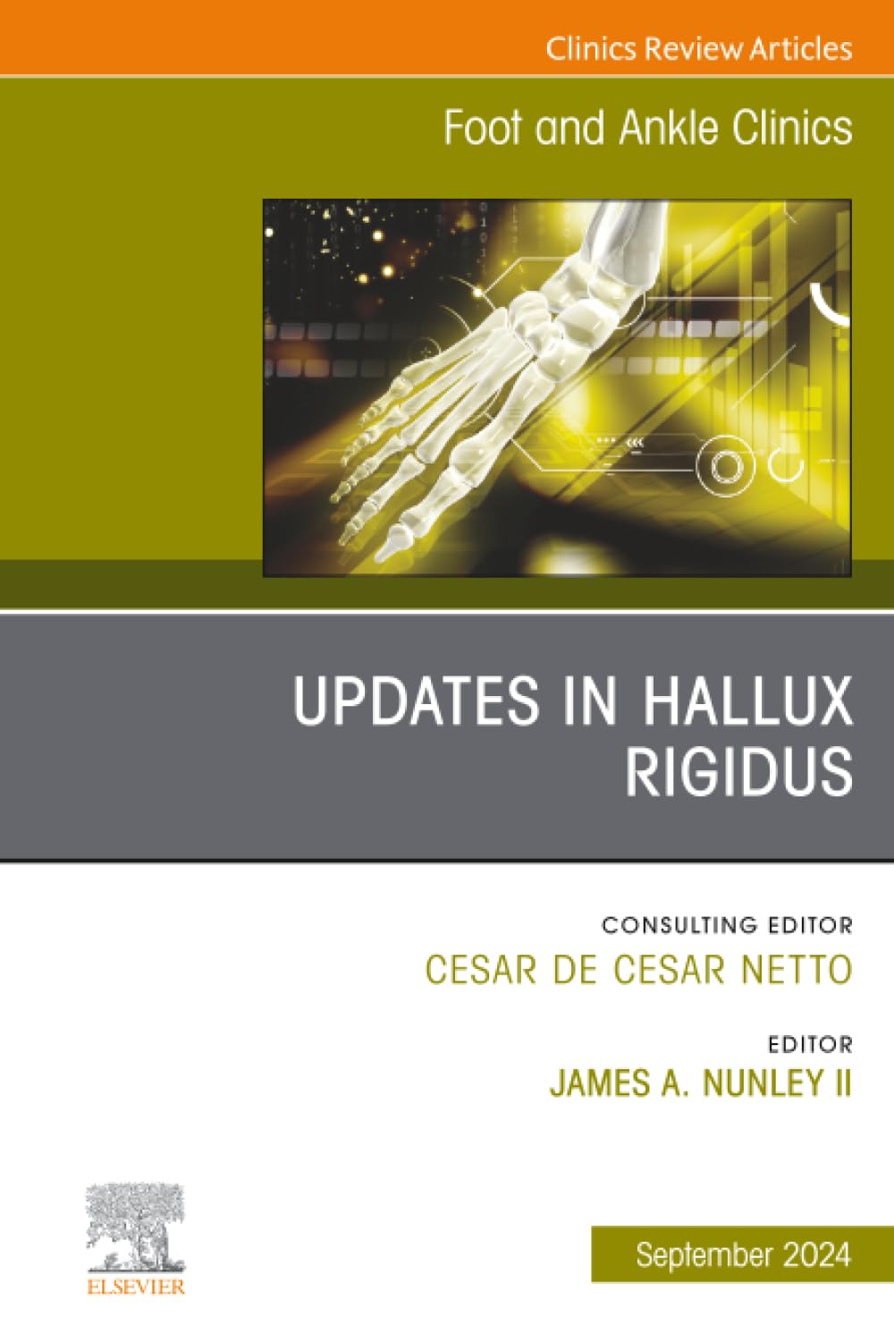 Updates in Hallux Rigidus, An issue of Foot and Ankle Clinics of North America: Volume 29-3 (The Clinics: Orthopedics, Volume 29-3)