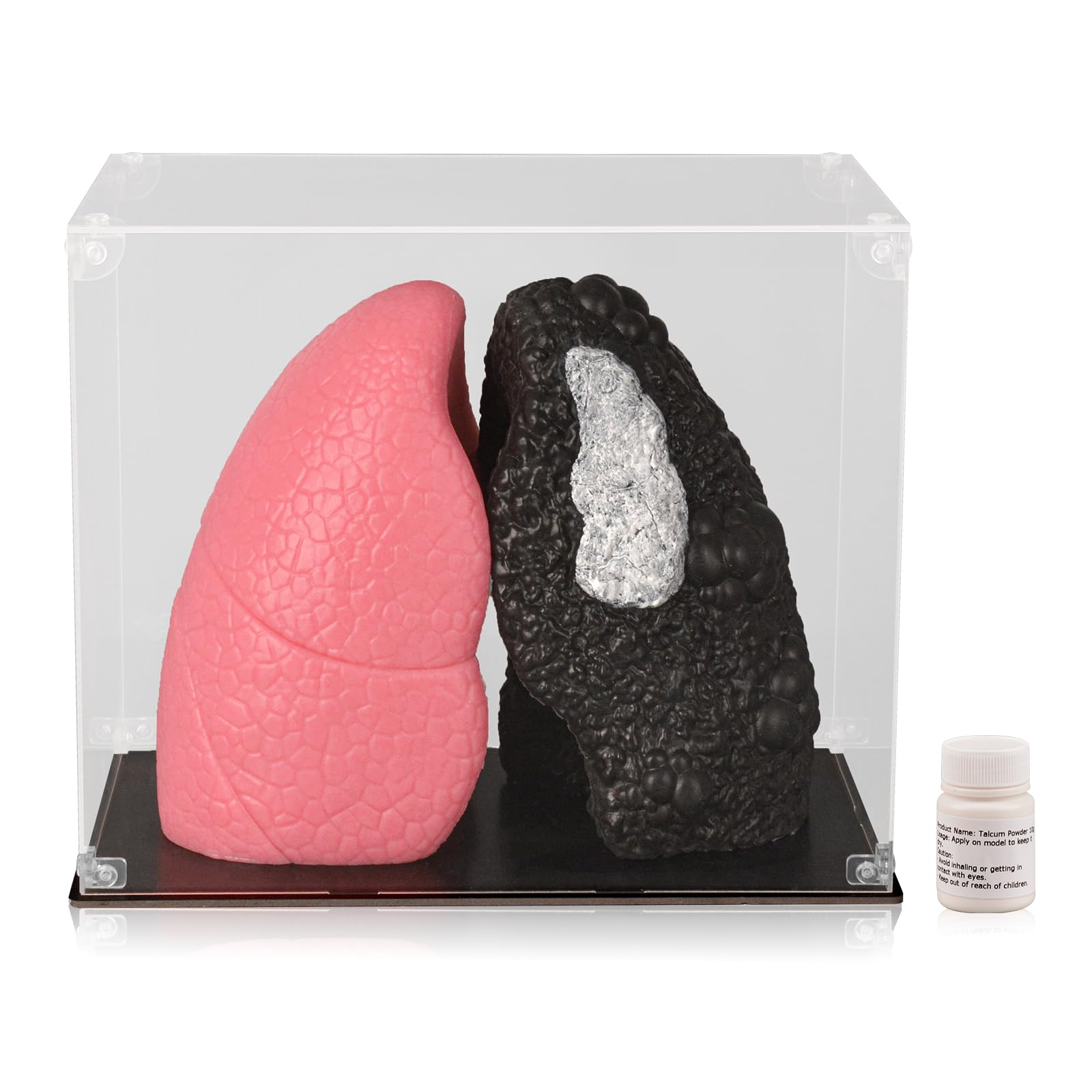 Ultrassist Healthy Lung vs. Smokers Lung Model Set, Lung Anatomy Model for Smoking Education - Life Size