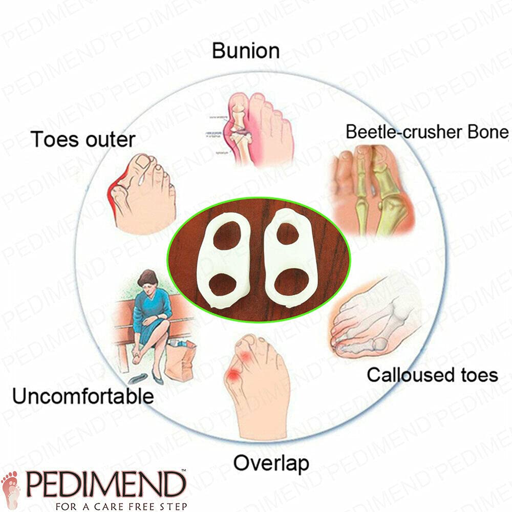 PedimendTM, 3 paia di cuscinetti per sollievo dal dolore per alluce valgo, separatore in gel di silicone, correttore per dita dei piedi