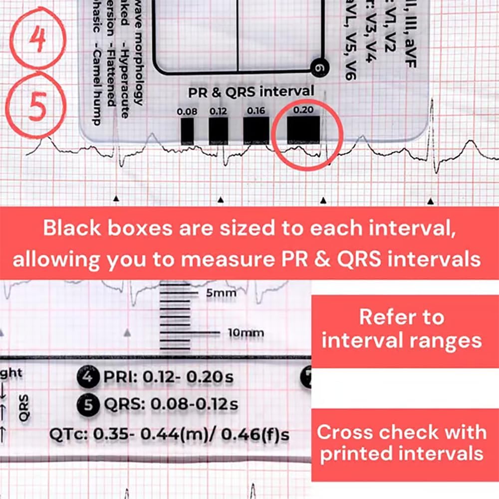 ECG 7 Step Ruler, ECG Ruler Measuring Tool for Australia | Ubuy
