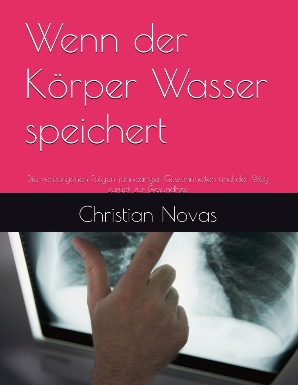 Wenn der Körper Wasser speichert: Die verborgenen Folgen jahrelanger Gewohnheiten und der Weg zurück zur Gesundheit