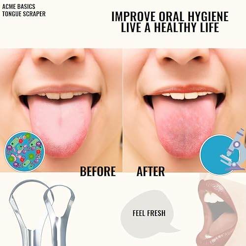 Miniatura 4 de Paquete de raspador de lengua para adultos y niños (paquete de 4). Limpiadores de lengua de acero inoxidable para reducir el mal aliento y el