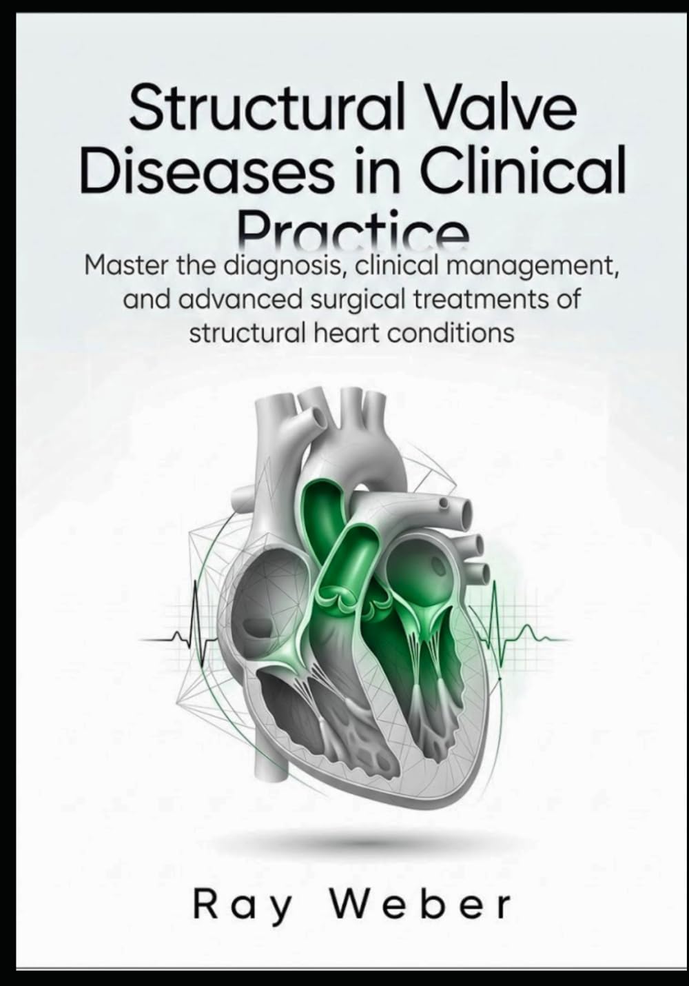 Structural Valve Diseases in Clinical Practice: Master the diagnosis, clinical management, and advanced surgical treatments of structural heart ... your heart. Protect your heart. Live longer.)