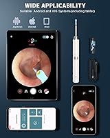 Vista 5 de Eliminación de cera de oídos, limpiador de oídos con cámara y luz, kit de eliminación de cera de oídos con otoscopio 1296P, herramienta de limpieza