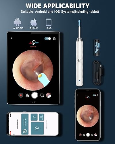 Miniatura 5 de Eliminación de cera de oídos, limpiador de oídos con cámara y luz, kit de eliminación de cera de oídos con otoscopio 1296P, herramienta de limpieza