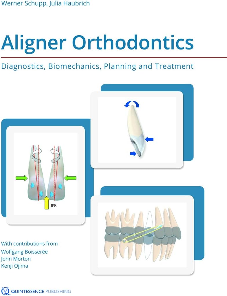 Aligner Orthodontics: Diagnostics, Biomechanics, Planning and Treatment