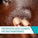 CeraVe Acne Treatment Face Wash, Salicylic Acid Cleanser with Purifying Clay, Niacinamide, and Ceramides, Pore Control and Blackhead Remover, 8 Ounce - Image 4