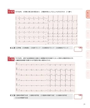 心電図7日間最強ブースト マイスターと鍛える1・2級合格への