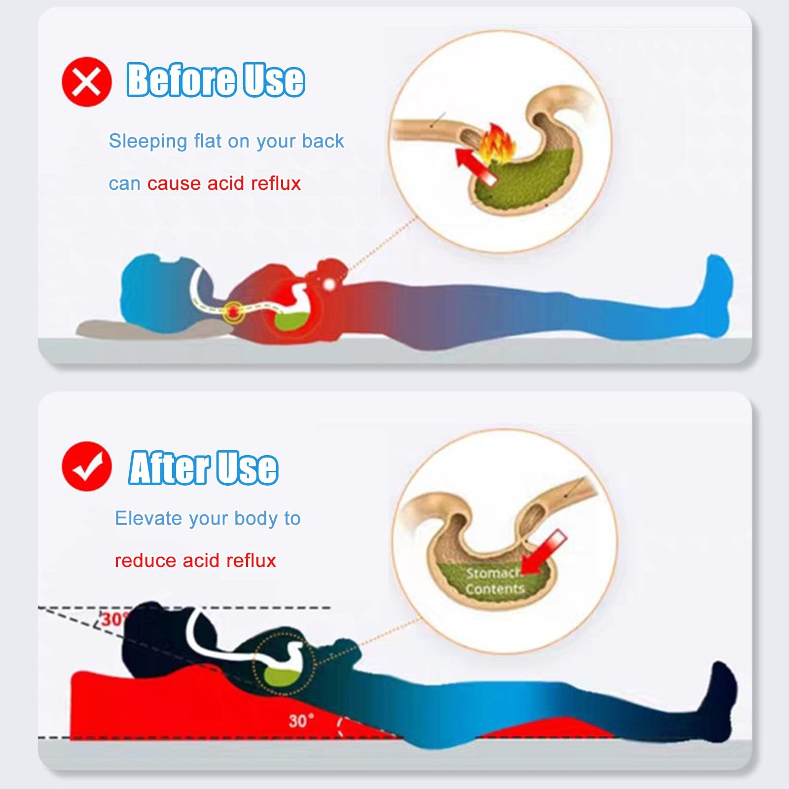 keilkissen bett keilkissen bett kopfteil Matratzenkeil gegen sauren Reflux, dreieckiges erhöhtes Kissen mit waschbarem Reißverschlussbezug für Erwachsene/ältere Menschen/Schwangere/Kinder, Rampenmatra