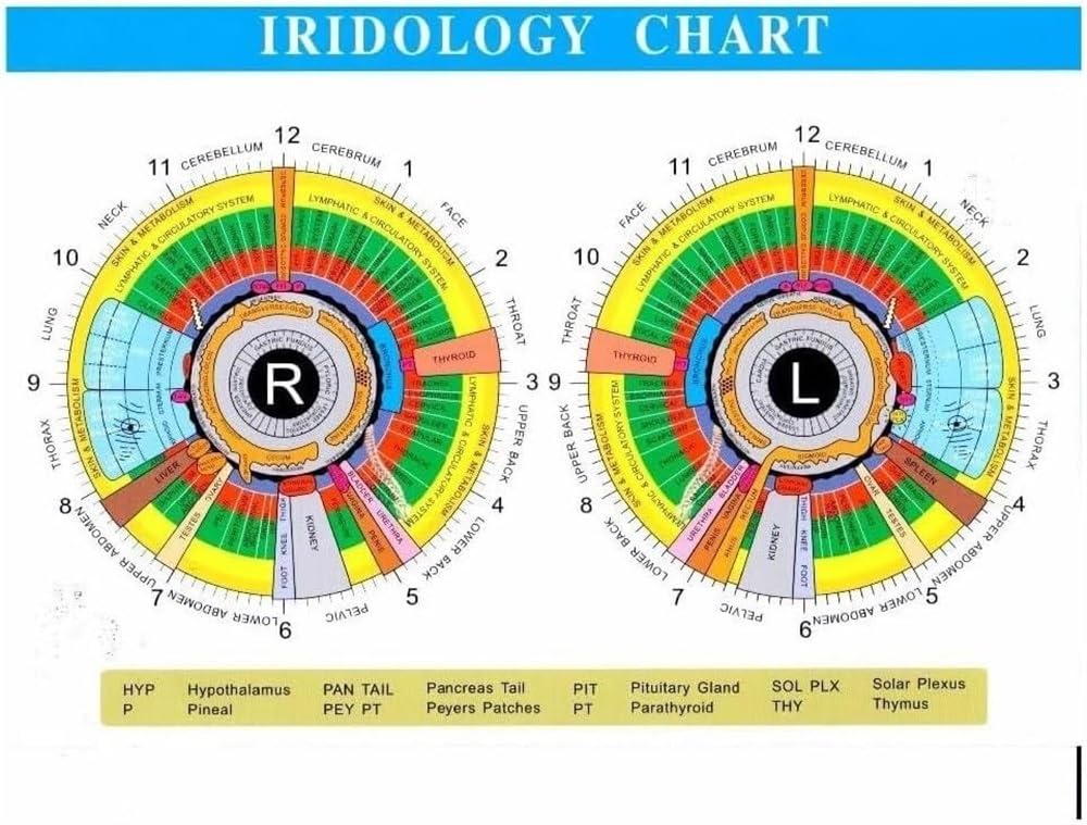 Cámara de iridología, analizador de iris multifunción, cámara de análisis de iris específica for computadora USB, con caja de aluminio + HD 13 millones de píxeles + software de análisis de iris