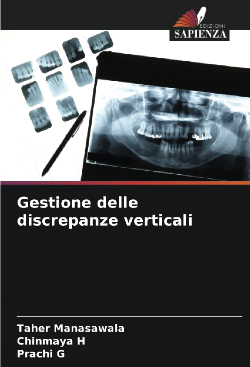 Gestione delle discrepanze verticali (Italian Edition)