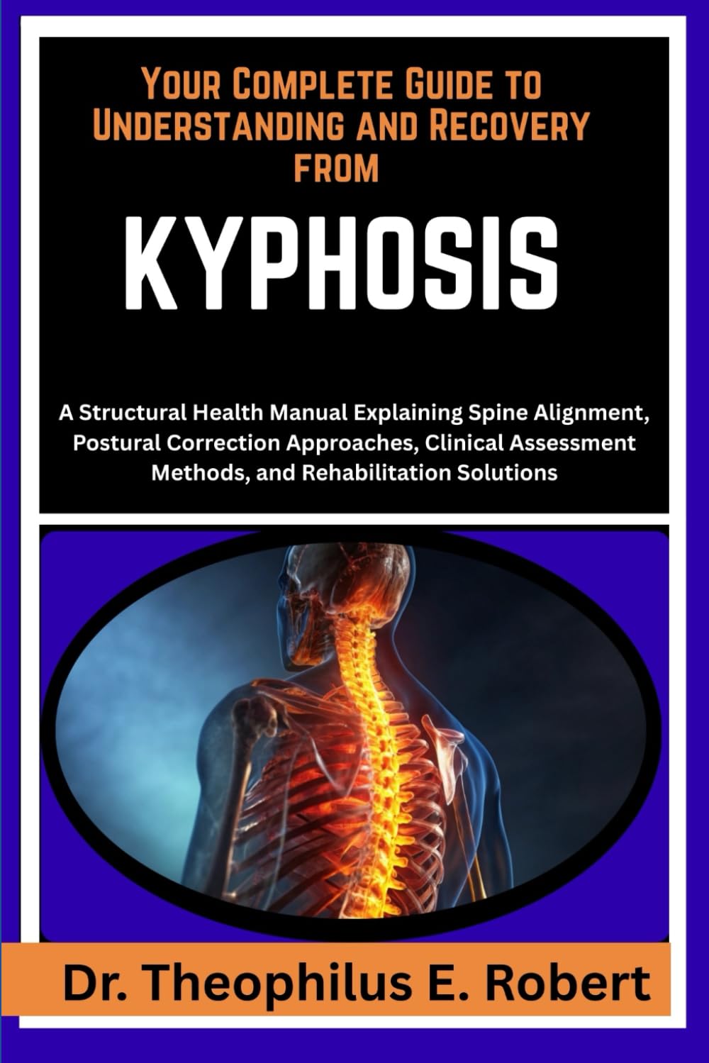 YOUR COMPLETE GUIDE TO UNDERSTANDING AND RECOVERY FROM KYPHOSIS: A Structural Health Manual Explaining Spine Alignment, Postural Correction ... Methods, and Rehabilitation Solutions