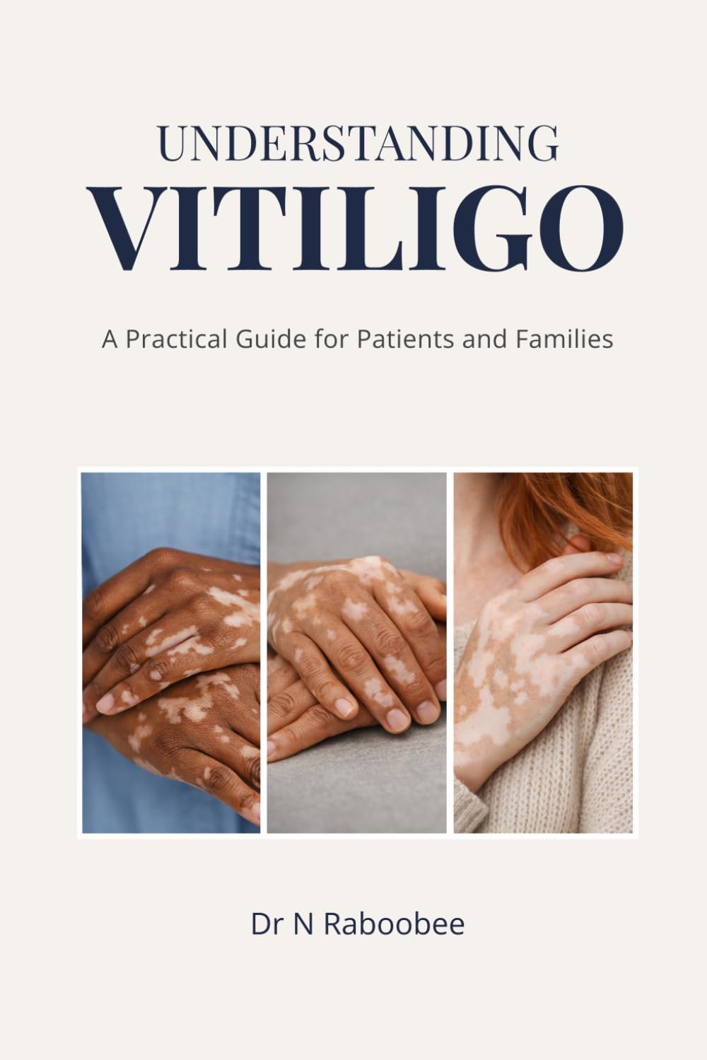 Understanding Vitiligo: A Practical Guide for Patients and Families