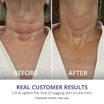 goPure Tighten & Lift Neck & Chest Moisturizer Cream for Visibly Firming, Tightening and Lifting the Look of Wrinkles & Crepey Skin, 1.7oz - Pack of 2