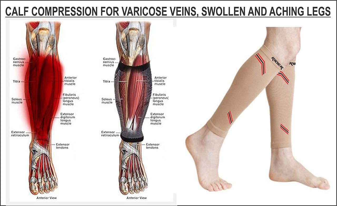 Just Rider Calf Compression Sleeve Women, 1 Pairs 20-30mmHg Footless Compression Socks Stockings for Calf Support, Circulation, Swelling, Shin Splints, Varicose Veins, Recovery (Beige, XL) Just Rider Calf Compression Sleeve Women, 1 Pairs 20-30mmHg Footless Compression Socks Stockings for Calf Support, Circulation, Swelling, Shin Splints, Varicose Veins, Recovery (Beige, XL)