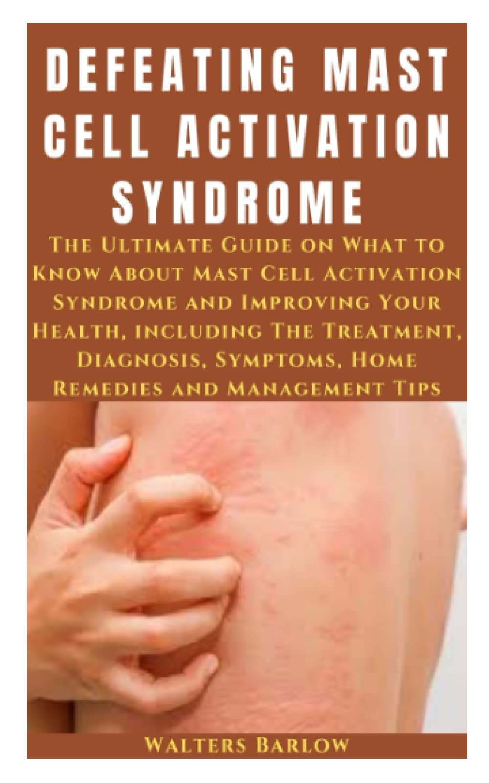 Buy DEFEATING MAST CELL ACTIVATION SYNDROME : The Ultimate Guide on ...