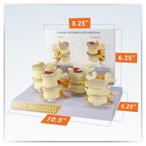Miniatura 5 de Modelo de columna vertebral  Réplica de anatomía corporal humana de condiciones de vértebras de cuatro etapas para médicos herramienta educativa de