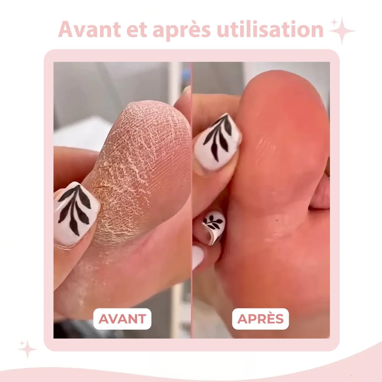 Honey Glow Pied, Mielle Ponceuse Pied, Rape Pieds Électrique, Avec 60 Tampons Glide Pour Éliminer Efficacement Et Sans Douleur Les Callosités,honeyglow kit beauté pieds