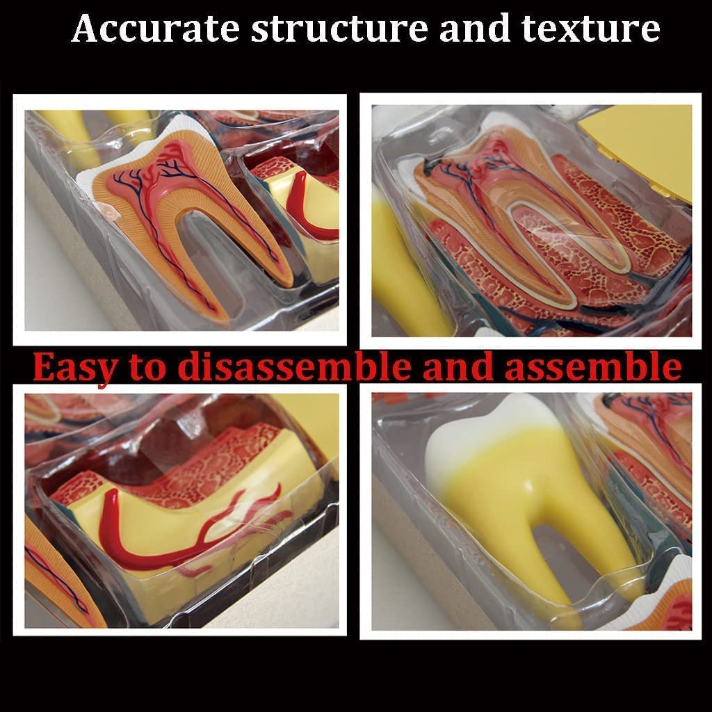 Amazon.co.jp: FANNKE 解剖模型 4D 人間の歯の構造模型 標準的な歯の