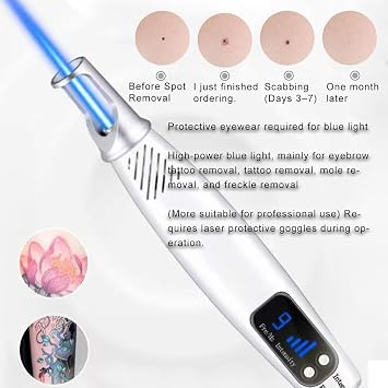 Picosecond Laser Pen, Skin Tags Remover Pen, Dot Mole Remover Skin, Smart Beauty Machine, Portable Removal Machine, for Tattoo Acne Skin Pigment Freckle Removal Dark Spot Remover (Blue Light)