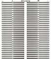 Lulultn 3/16 T316 Stainless Steel Cable Railing Hardware, System Kit, Swage Lag Screws Left & Right 30 Pairs