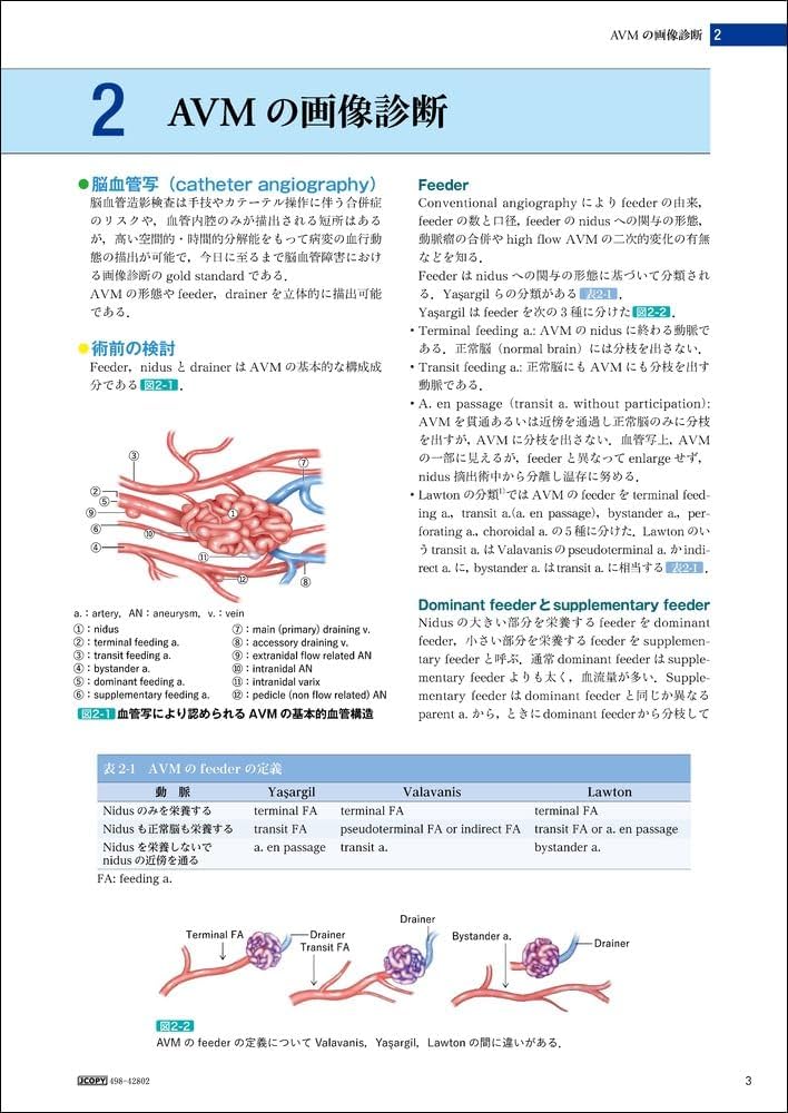 脳動静脈奇形の手術 | 富永 紳介 |本 | 通販 | Amazon