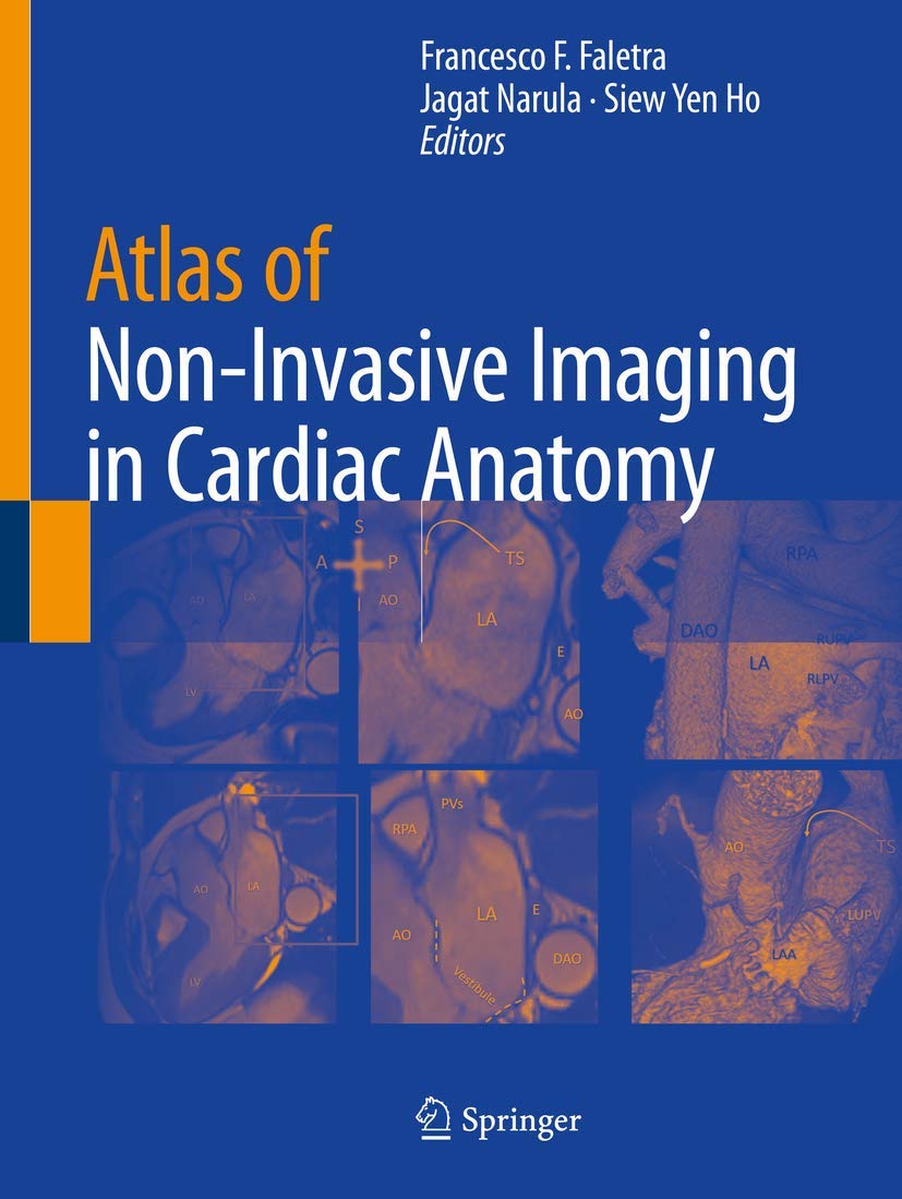Buy Atlas of Non-Invasive Imaging in Cardiac Anatomy — BookShops.in