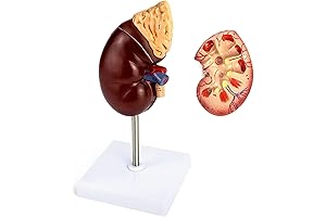 QWORK Life-Size Human Kidney Model Meticulously Partitioned for Medical Study or Standard Classroom Lesson