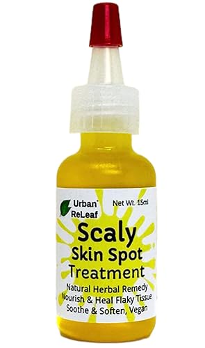 Urban ReLeaf Tratamiento de manchas de piel escamosa. Aceite reparador suavizante de la piel, alivio natural para manchas escamosas, agrietadas y