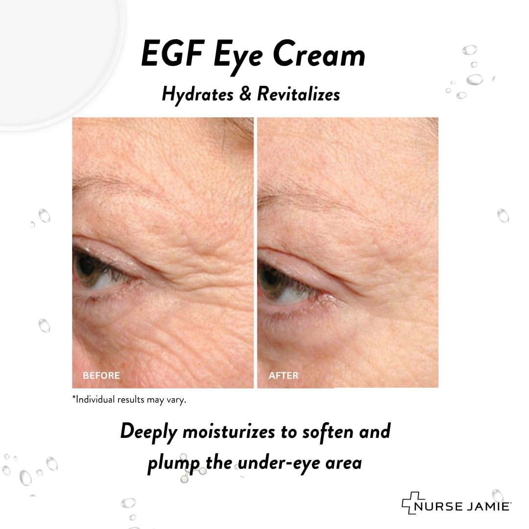 Nurse Jamie EGF Eye Cream – Hydrating & Firming Treatment for Dark Circles, Puffiness & Fine Lines