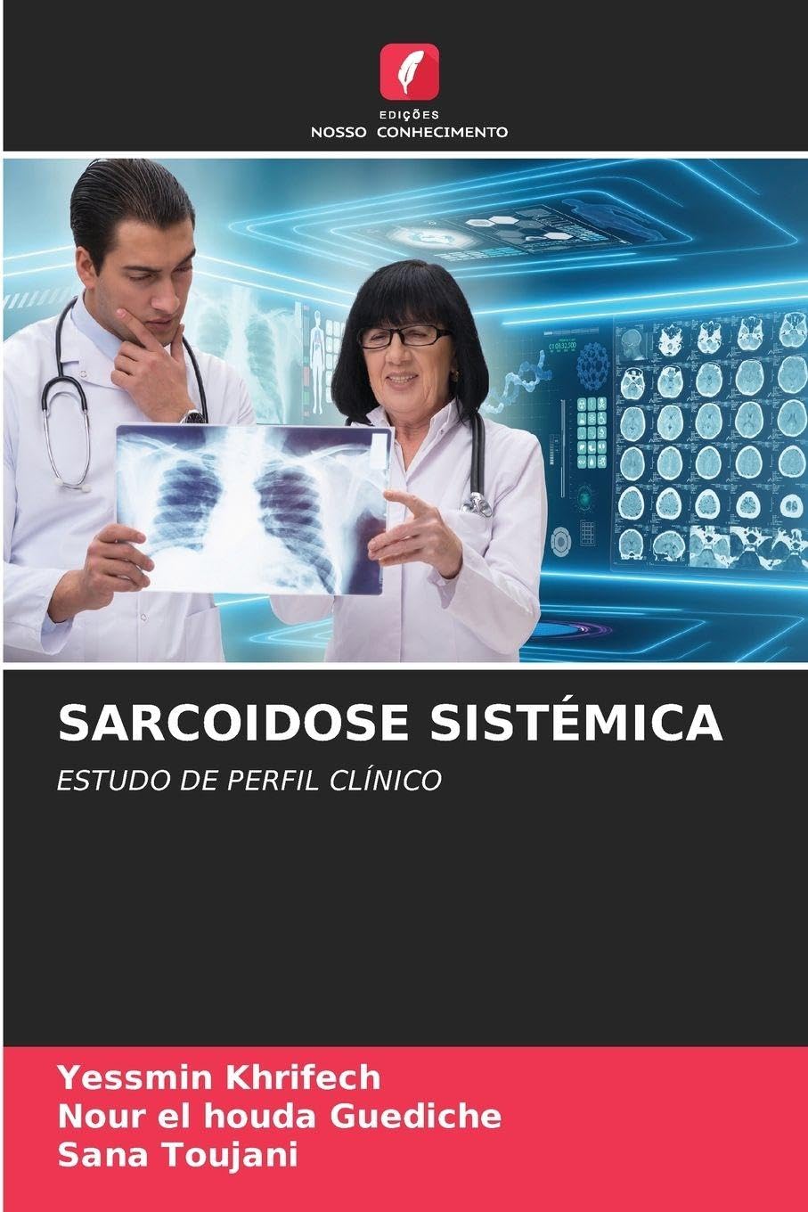 Sarcoidose Sistémica: ESTUDO DE PERFIL CLÍNICO